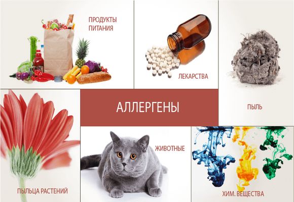 Лікування алергічного риніту у дитини