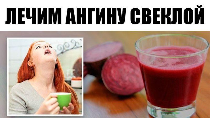 Лікування ангіни буряком і оцтом