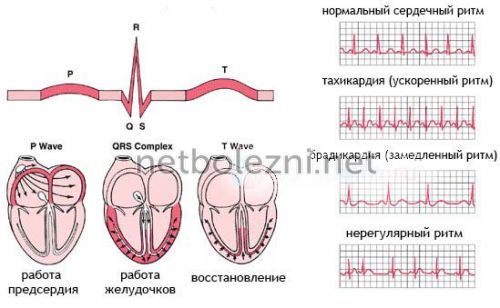 Лікування аритмії серця народними засобами і методами