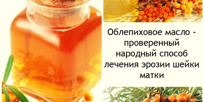 Лікування ерозії шийки матки народними способами