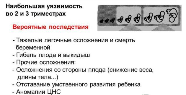 Лікування фарингіту при вагітності та його вплив на плід. Особливості лікування фарингіту при вагітності