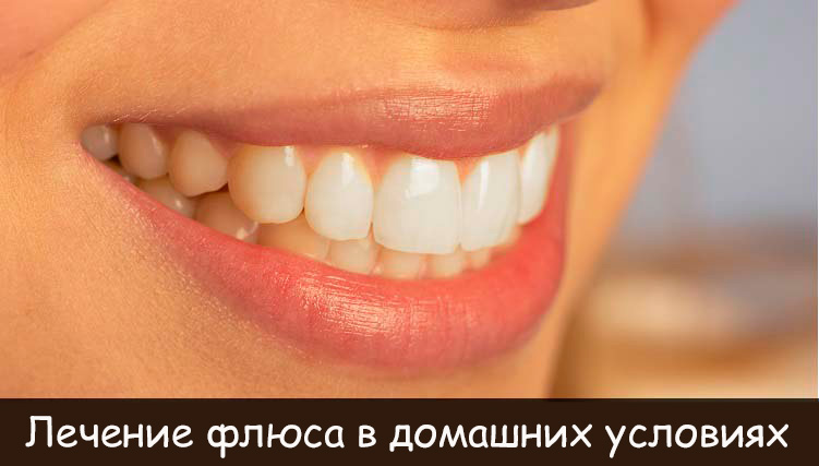 Лікування флюсу в домашніх умовах народними засобами