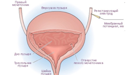 Лікування гіперактивного сечового міхура