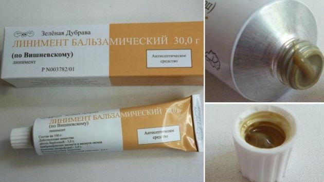 Лікування гаймориту без проколів в домашніх умовах