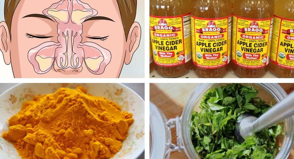 Лікування гаймориту гомеопатією. Огляд гомеопатичних препаратів