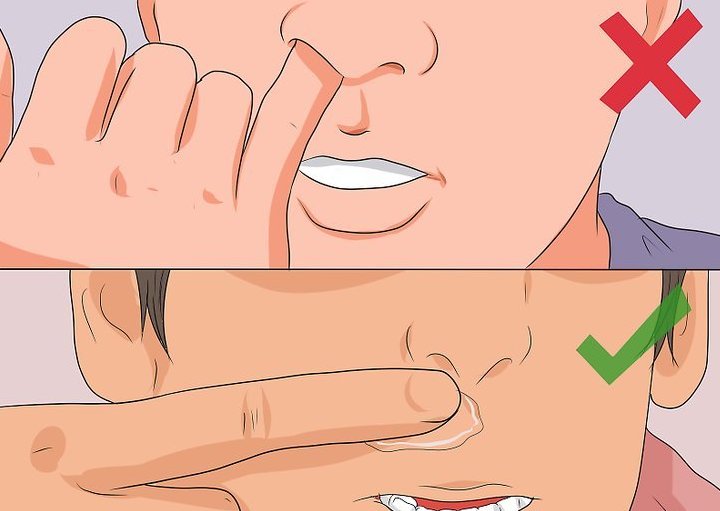 Лікування гаймориту гомеопатією. Огляд гомеопатичних препаратів