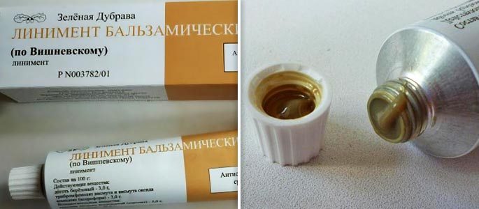 Лікування гаймориту маззю Вишневського у складі комплексної терапії