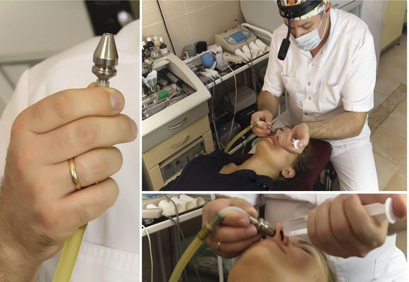 Лікування гаймориту методом «Зозуля»