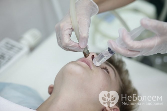 Лікування гаймориту методом «Зозуля»