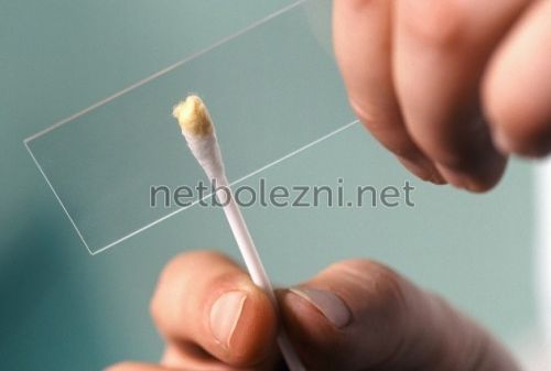 Лікування гаймориту народними засобами в домашніх умовах