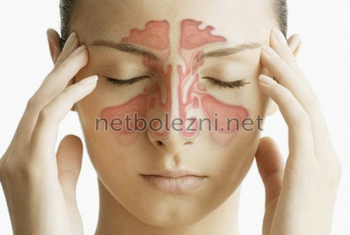 Лікування гаймориту спреями найефективніші препарати