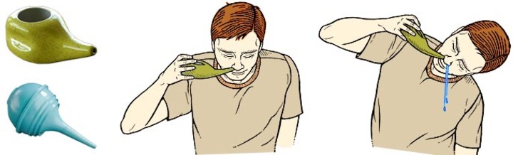 Лікування гаймориту у дорослих народні традиційні методи і профілактика Лікування гаймориту у дорослих народні традиційні методи і профілактика