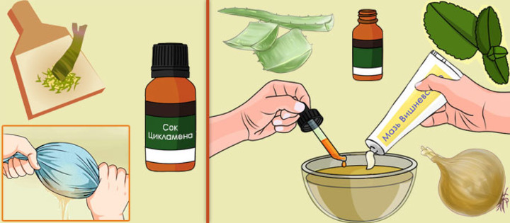 Лікування гаймориту у дорослих народні традиційні методи і профілактика Лікування гаймориту у дорослих народні традиційні методи і профілактика