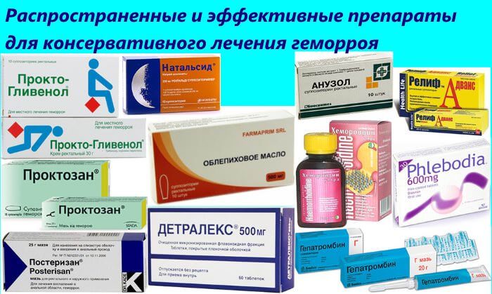 Лікування геморою в домашніх умовах швидко