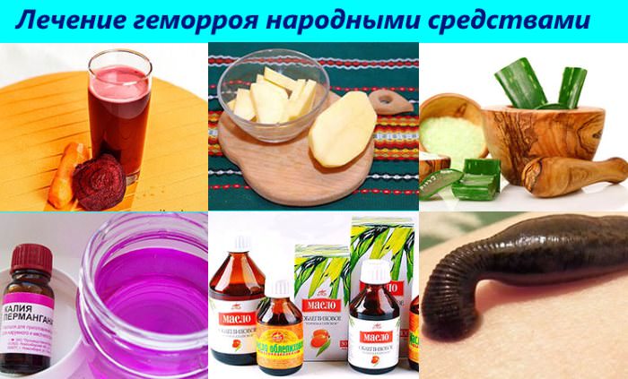 Лікування геморою в домашніх умовах швидко
