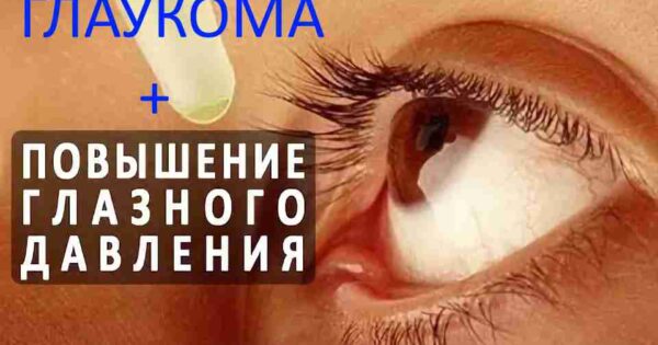 Лікування глаукоми народними засобами відгуки Народні засоби Корекція зору