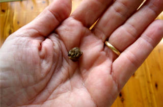 Лікування горла прополісом — рецепти настоянок та правила застосування