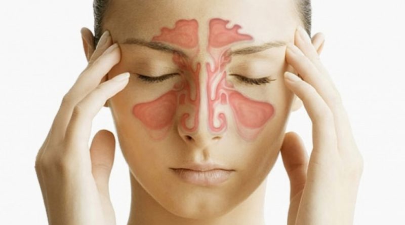 Лікування хронічного гаймориту народними засобами в домашніх умовах