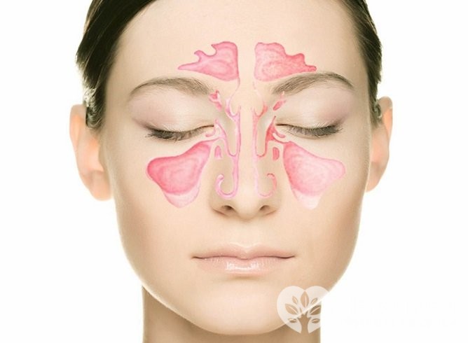 Лікування хронічного гаймориту народними засобами в домашніх умовах