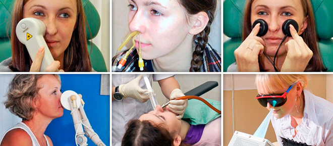 Лікування хронічного гаймориту Шлях до успіху Лікування хронічного гаймориту Шлях до успіху