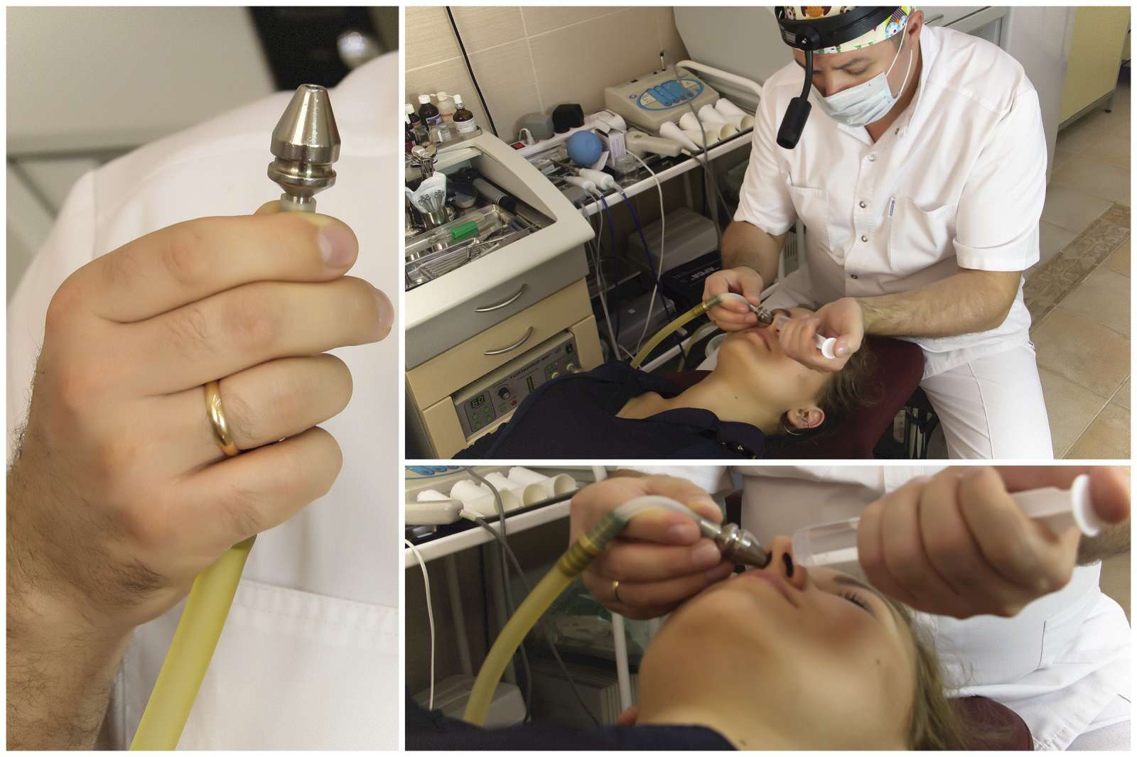 Лікування хронічного гаймориту Шлях до успіху Лікування хронічного гаймориту Шлях до успіху