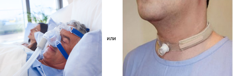 Лікування хропіння лазером – суть методу. Показання та протипоказання Лікування хропіння лазером – суть методу. Показання та протипоказання