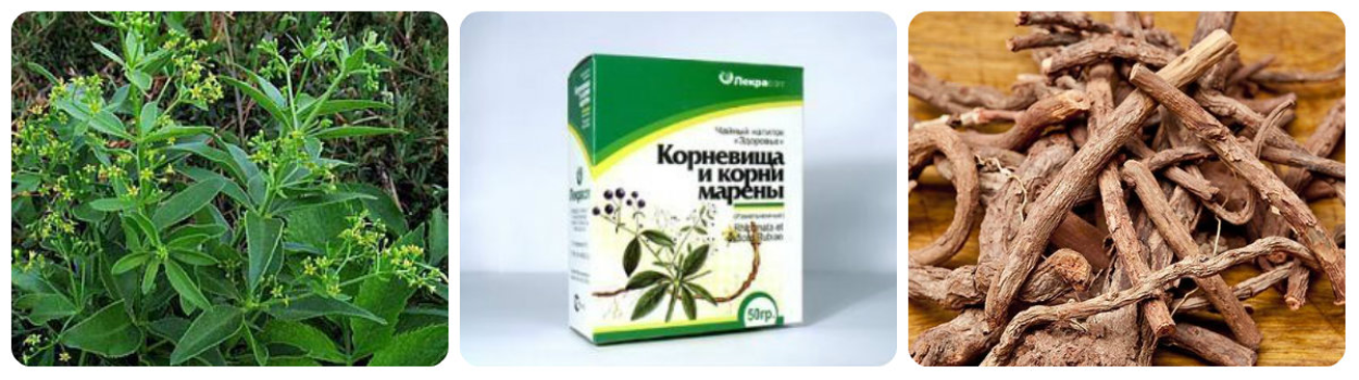 ЛІКУВАННЯ КІСТОЧКИ НА НОЗІ НАРОДНИМИ ЗАСОБАМИ