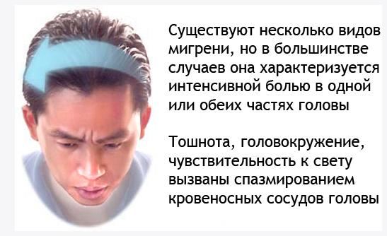 Лікування мігрені у жінок народними засобами