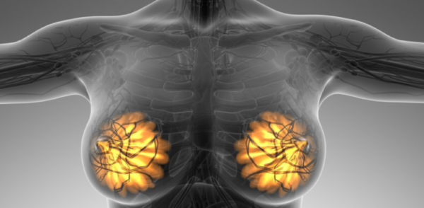 Лікування мастопатії народними засобами в домашніх умовах: рецепти, які допомогли позбутися патології молочної залози