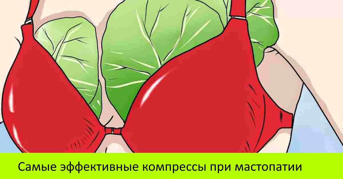 Лікування мастопатії народними засобами в домашніх умовах, рецепти які реально допомогли Лікування мастопатії народними засобами в домашніх умовах, рецепти які реально допомогли