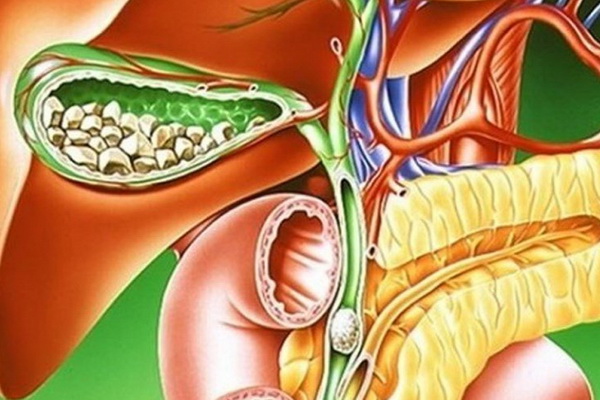 Лікування набряків народними методами: як зняти набряки народними засобами в домашніх умовах