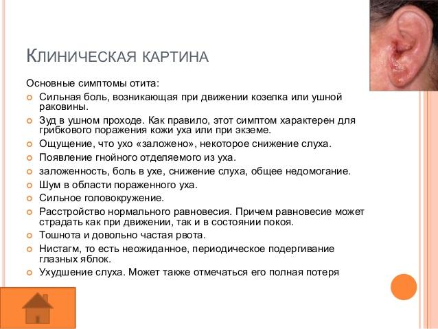 Лікування отиту у домашніх умовах народні методи