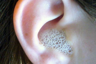 Лікування вуха перекисом водню при отиті