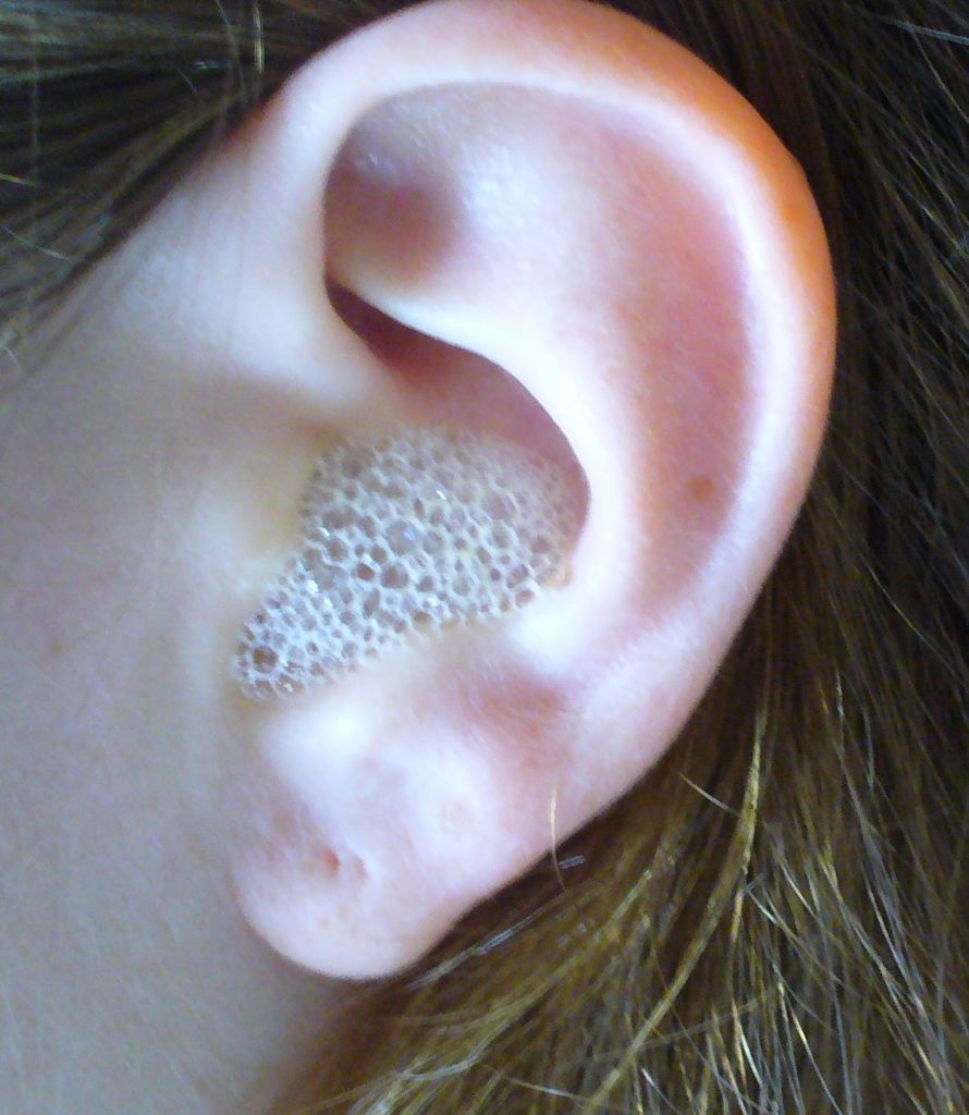 Лікування вуха перекисом водню при отиті