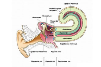 Лабіринтит або внутрішній отит