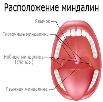 Лакунарна ангіна симптоми і лікування хвороби