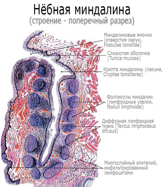 Лакунарна ангіна симптоми і лікування хвороби