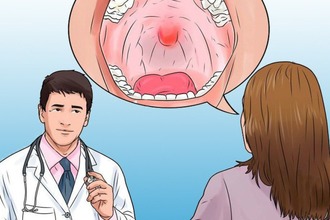 Ларинготрахеїт у дітей: симптоми і лікування. Гострий стенозуючий ларинготрахеїт