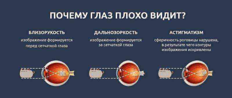 Лазерна корекція зору як проходить процедура види плюси і мінуси можливі ускладнення