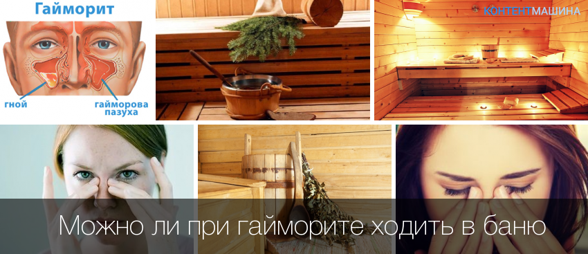 Лазня при гаймориті – шкода або користь для організму?