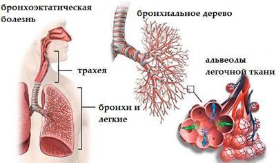 Мікстура коделак бронхо інструкція по застосуванню. Коделак Бронхо: склад, властивості та правила застосування