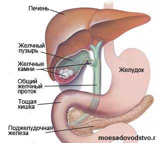 Мед проти жовчнокам’яної хвороби Мед проти жовчнокам’яної хвороби
