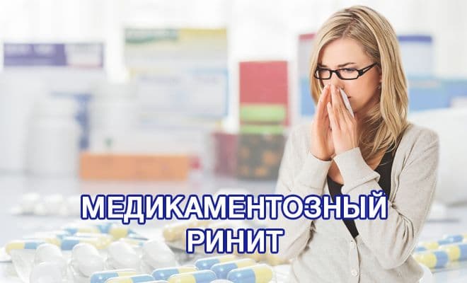 Медикаментозний риніт причини, ознаки, методи лікування