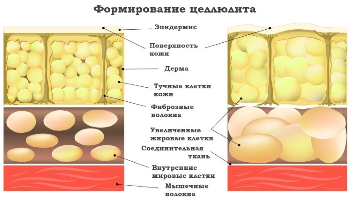 Медовий масаж для схуднення живота