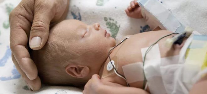 Механічна асфіксія – випадковість, нещасний випадок або насильство? Асфіксія — Невідкладна Допомога.