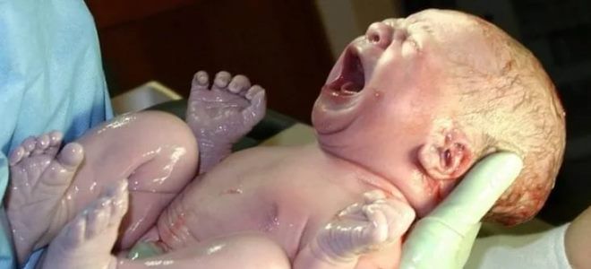 Механічна асфіксія – випадковість, нещасний випадок або насильство? Асфіксія — Невідкладна Допомога.