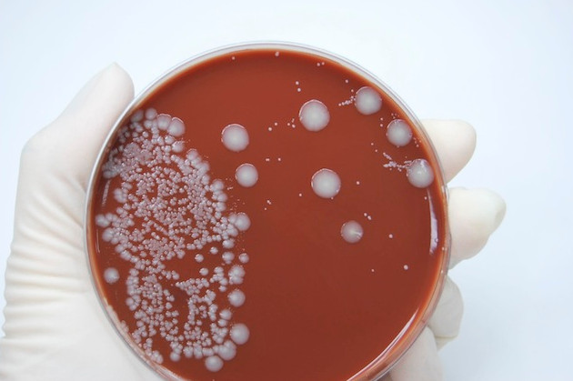 Менінгококовий сепсис або менінгококцемія симптоми у дітей і дорослих лікування можливість вижити