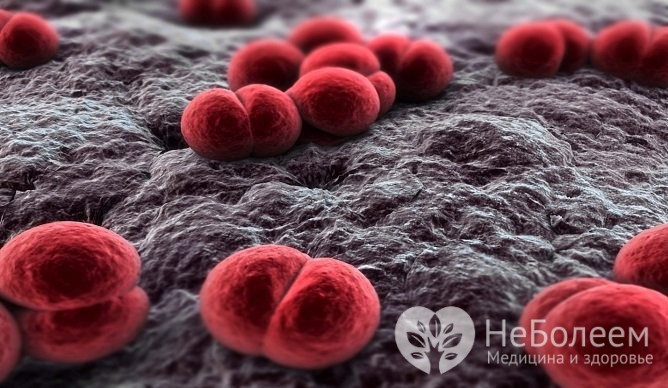 Менінгококовий сепсис або менінгококцемія симптоми у дітей і дорослих лікування можливість вижити