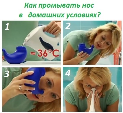 Методика промивання носа лікувальними розчинами. Як правильно промивати ніс солоною водою в домашніх умовах