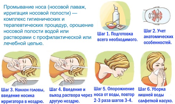 Методика промивання носа лікувальними розчинами. Як правильно промивати ніс солоною водою в домашніх умовах